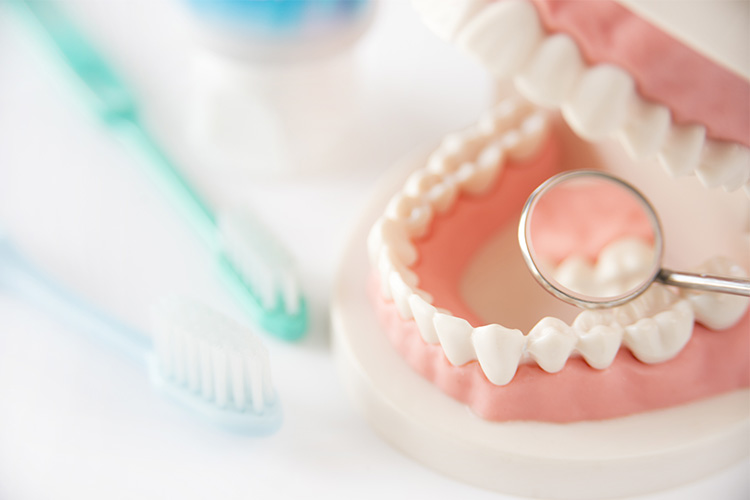 虫歯(むし歯)とは？