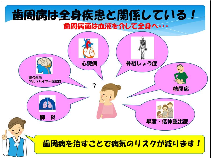 歯周病の予防は歯石を取り除くことです